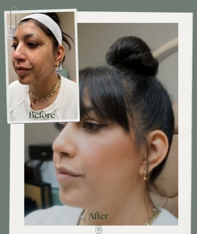 PDO threads before and after